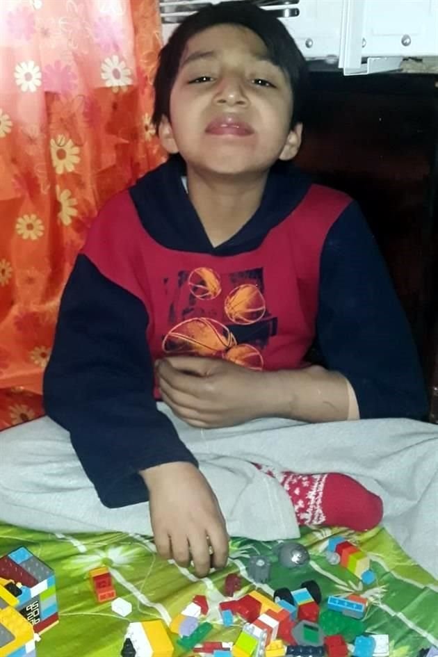 El pequeño Abraham ya pudo volver a jugar con cubos de colores, gracias a una prótesis bioeléctrica.