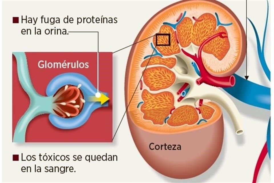 La falla de los riñones puede ser catastrófica.