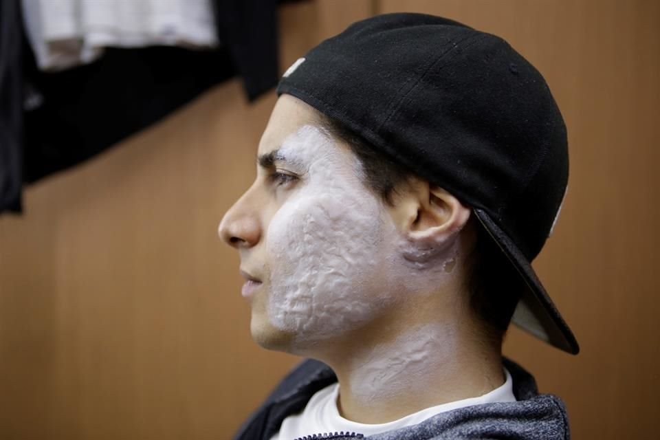 Antes y después de cada caracterización, aplican tratamientos para cuidar la piel del actor y no evitar alguna reacción alérgica.