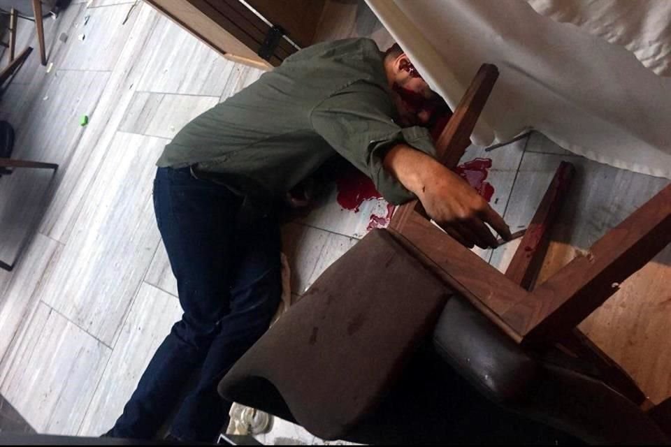 Durante la balacera en Artz Pedregal, un civil resultó herido de dos disparos en la cara