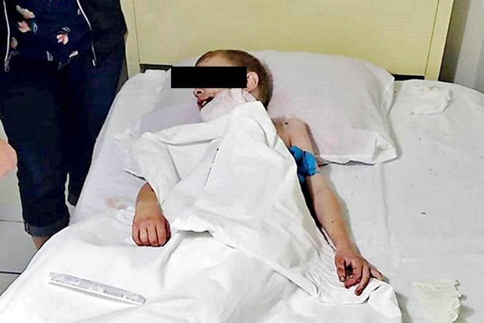 Cody Greyson Langford, de 8 años de edad, recibió una bala en la quijada y otra en la pierna.