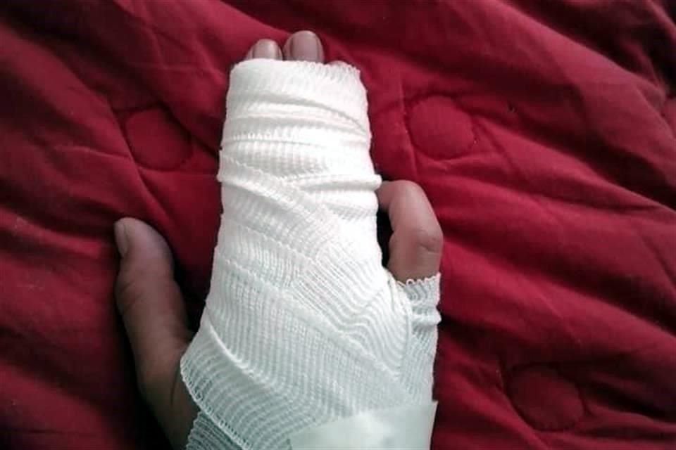 La enfermera agredida en San Luis Potosí tuvo una fractura de dedo.