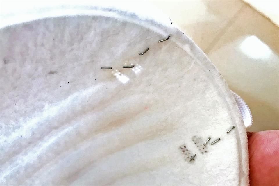 Aspecto del engrapado que los enfermeros del hospital han hecho ante la baja calidad de insumos del IMSS.