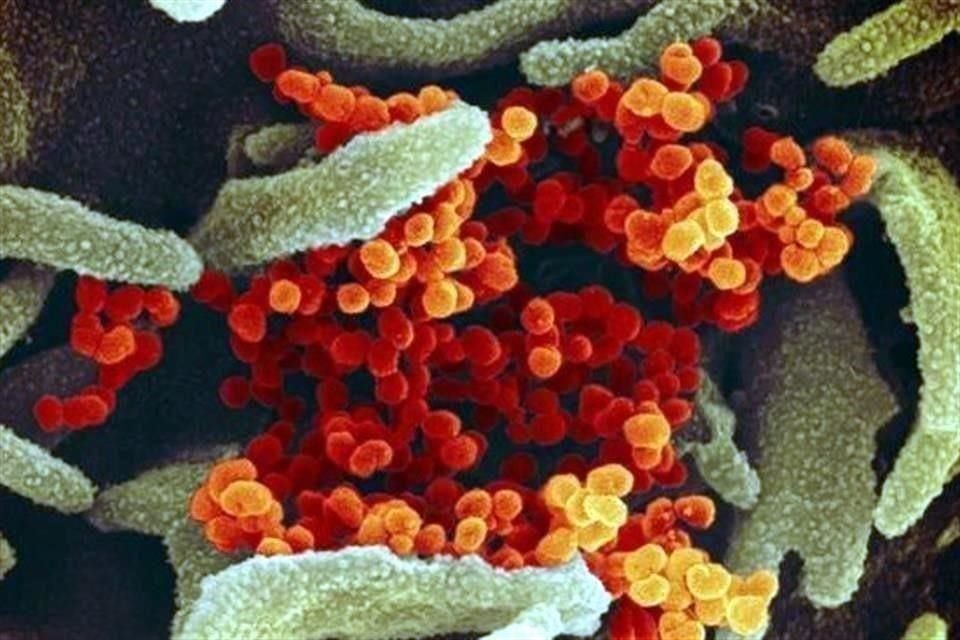 Los enfermos con Covid-19 se asocian con enfermedades crónicas; son hipertensos en un 17 por ciento, diabéticos en un 8 por ciento y padecen de enfermedad cardiovascular en un 5 por ciento.