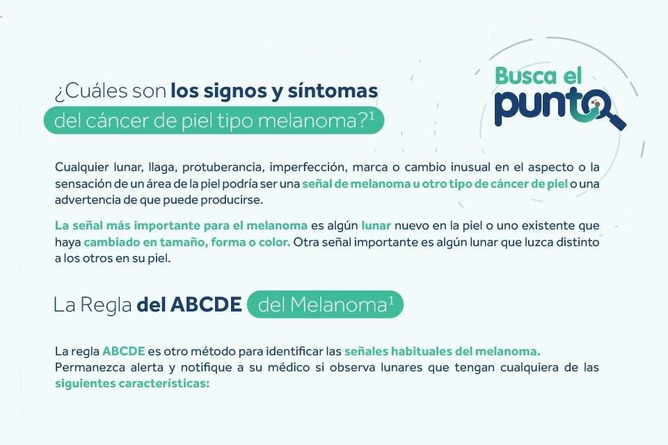 Existen algunas señales de que puede producirse el cáncer de piel tipo melanoma, aprende a identificarlas.