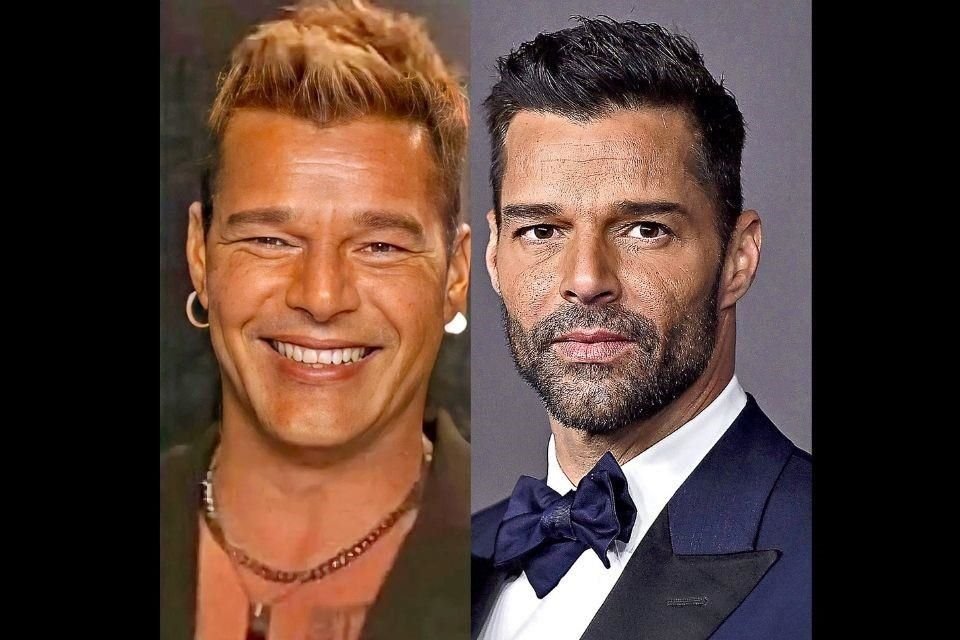 El nuevo look de Ricky Martin muestra: piel restirada y brillosa, ojos pequeños y rasgados, pómulos hinchados y una tonalidad demasiado bronceada.