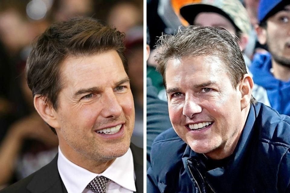 Especialistas dicen que Tom Cruise no ha recurrido a tratamiento estético, sino que subió unos kilos.