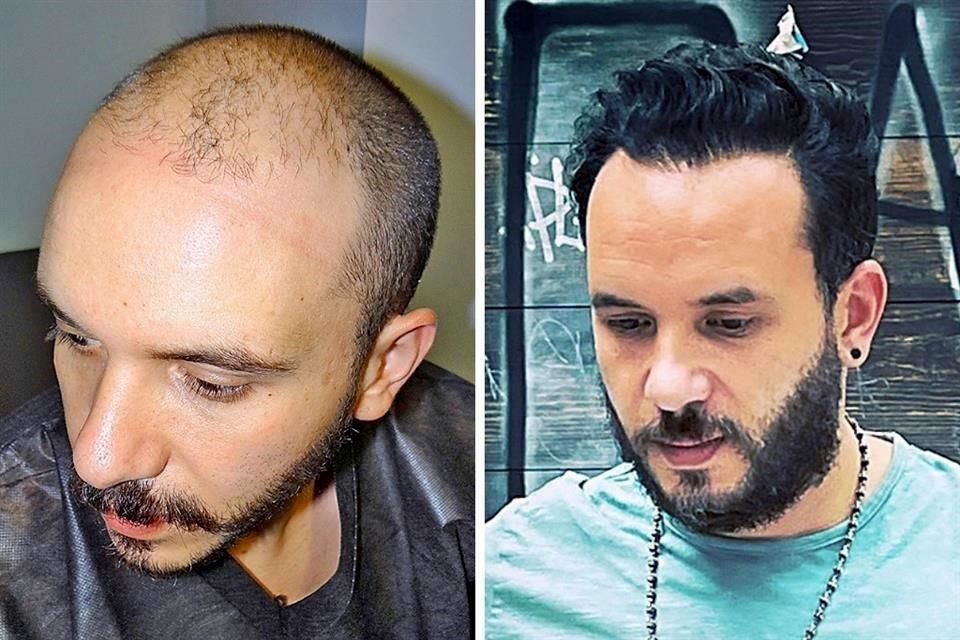 Antes y después.