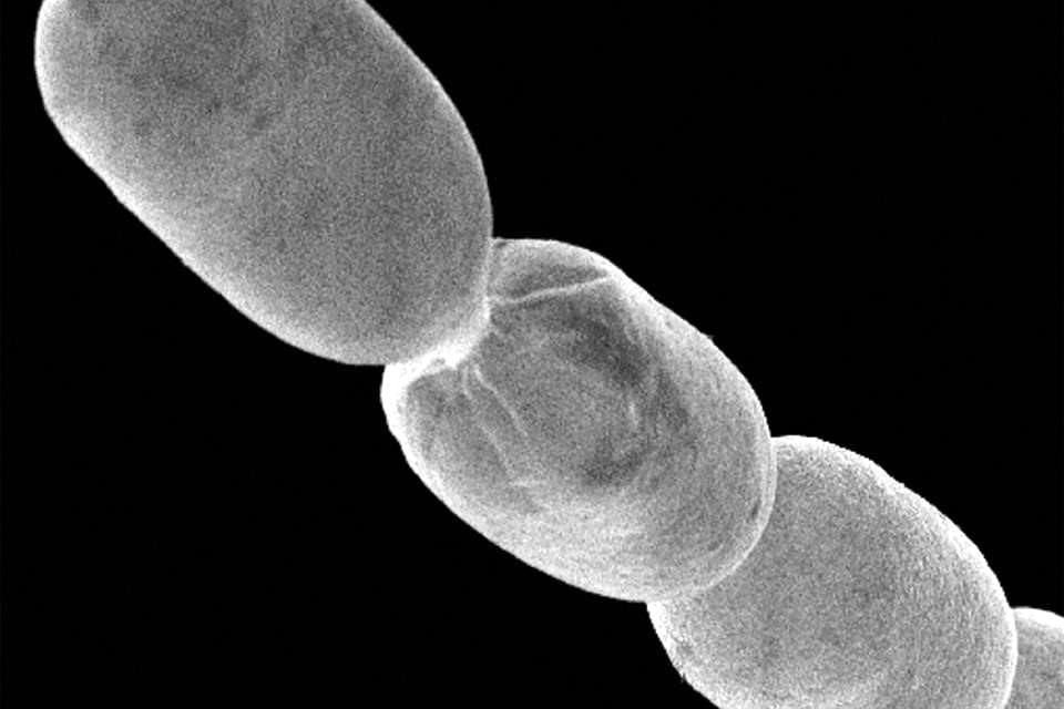 Al examinar su hallazgo bajo el microscopio, los expertos se dieron cuenta de que no estaba mirando un eucariota y que había encontrado algo especial.
