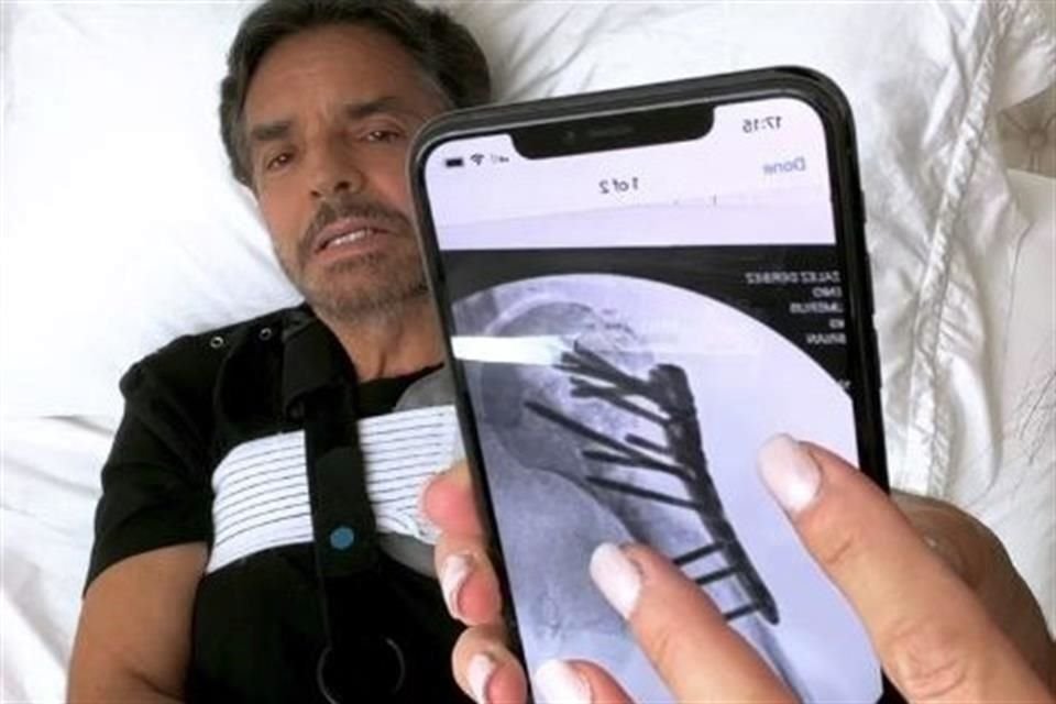 Eugenio Derbez reapareció en redes sociales para hablar sobre el accidente que tuvo mientras jugaba realidad virtual.