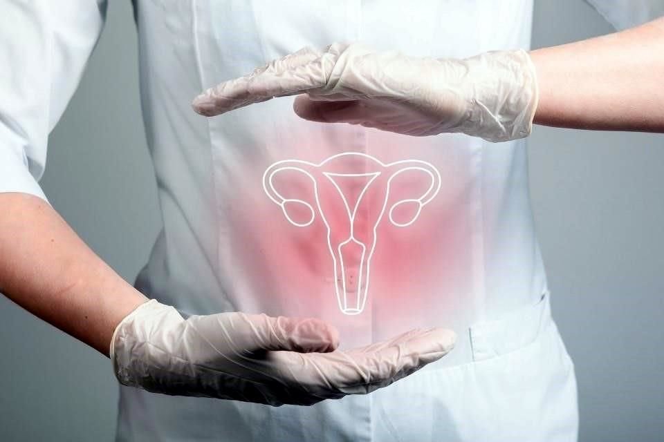 El cáncer cervicouterino es la segunda causa de muerte por cáncer entre las mujeres, precedido por el de mama.