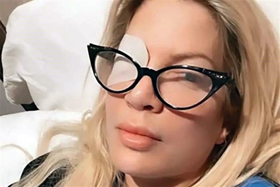 La actriz Tori Spelling compartió en su podcast que desarrolló una úlcera ocular por utilizar lentes de contacto.