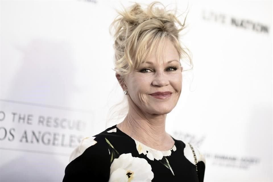 Melanie Griffith fue captada con extraños moretones en el rostro y las manos, saliendo del dermatólogo.