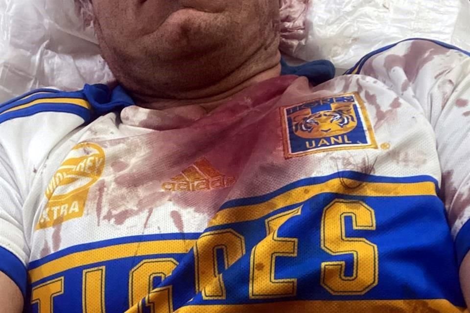 Algunos aficionados de Tigres fueron atacados por integrantes de la barra de Chivas.