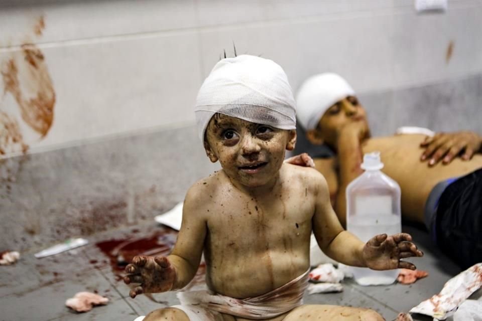 Niños palestinos heridos yacían en el hospital al-Shifa, tras los ataques aéreos israelíes.