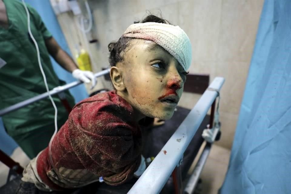 Un niño palestino herido en el bombardeo israelí es llevado al hospital Al-Aqsa.