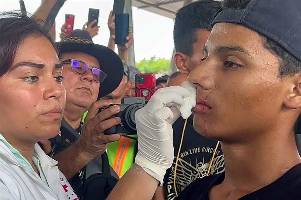 Este jueves varios migrantes  se suturaron los labios como medida de protesta al Instituto Nacional de Migración para ser atendidos.