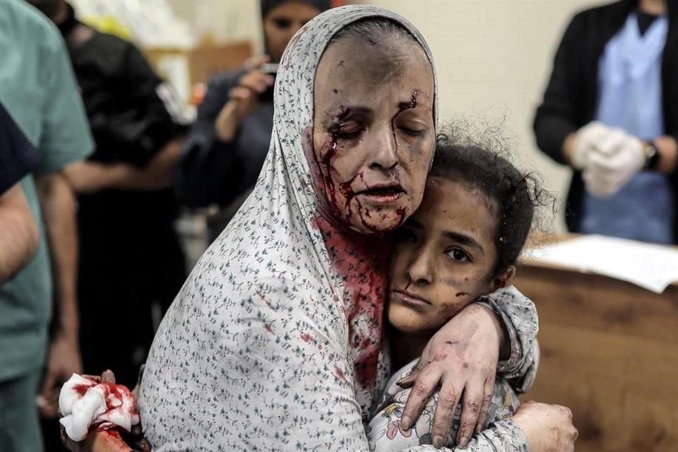 Una mujer palestina herida cubierta de polvo y sangre abraza a una niña herida en el hospital tras el bombardeo israelí de Khan Yunis.