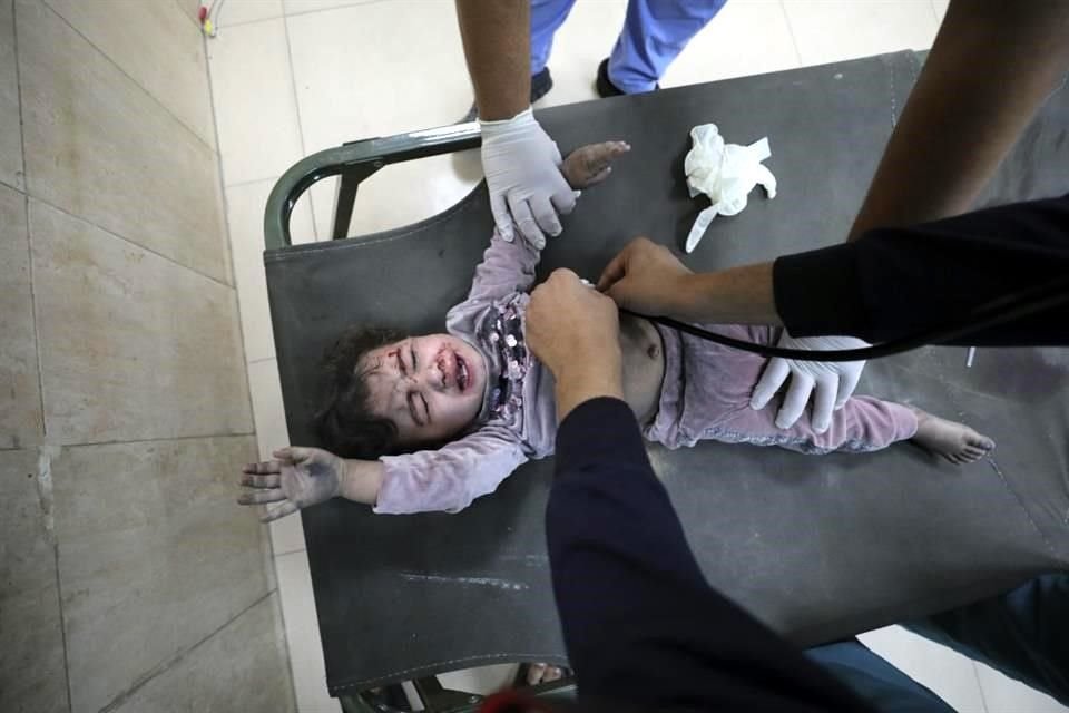 Un niño palestino herido en el bombardeo israelí de la Franja de Gaza recibe tratamiento en el Hospital al Aqsa en Deir al Balah.