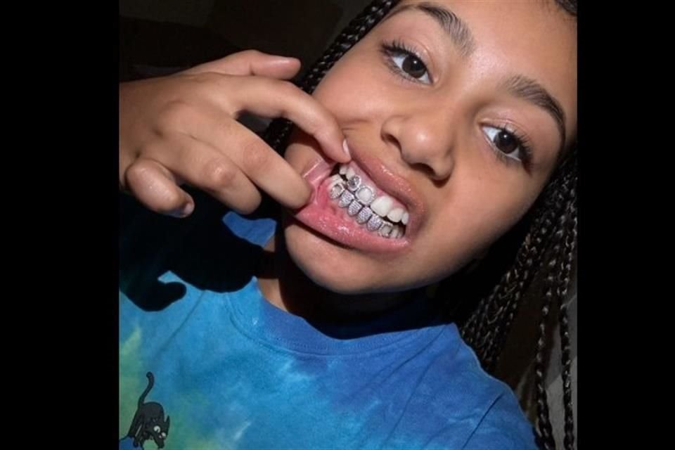 La hija de Kanye West y Kim Kardashian cuenta con las carillas dentales a sus 10 años.