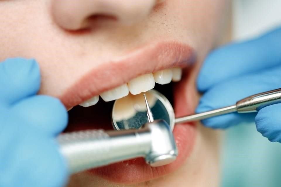 En México, los viajeros de Estados Unidos pueden ahorrar más de 65 por ciento del costo de un servicio dental.