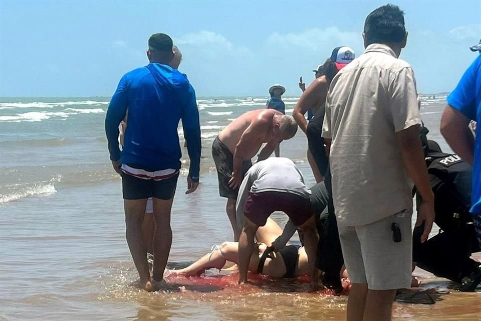 Entre los atacados por un tiburón está una mujer, que fue mordida en la pierna izquierda. Fue atendida en la playa por paseantes, mientras arribaban paramédicos de Bomberos.