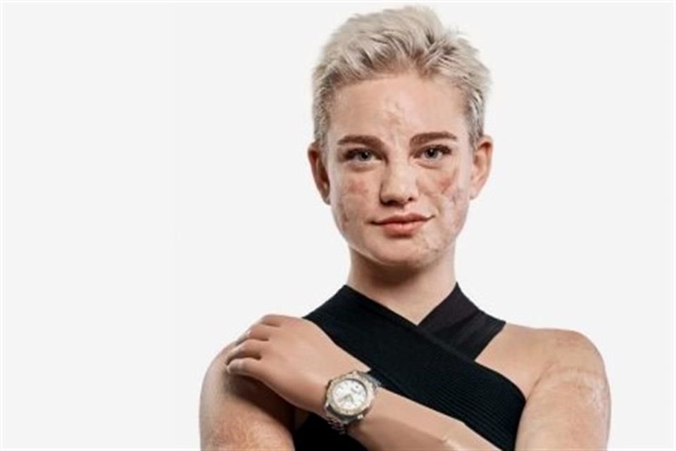 La multimedallista paralímpica Beatrice Vio junto con su reloj OMEGA.