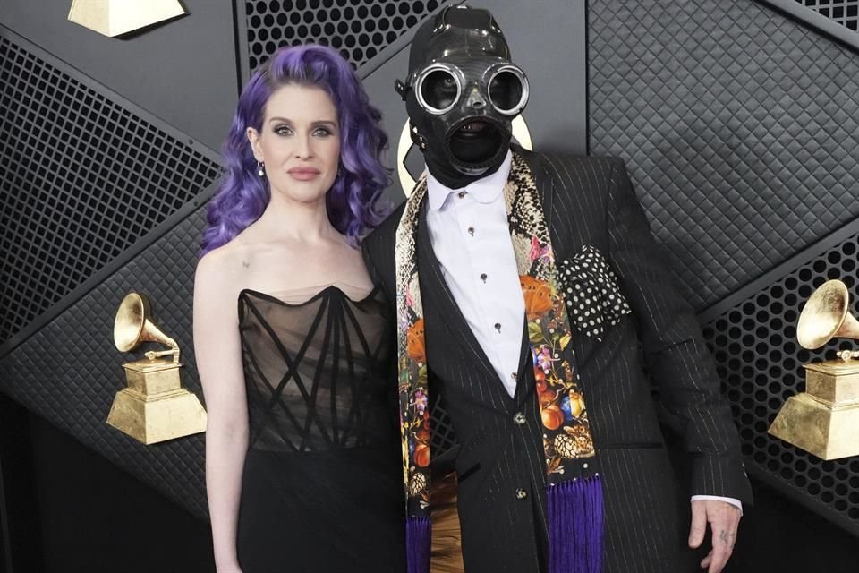 El también esposo de Kelly Osbourne contó que el accidente le achicharró cejas, le provocó ampollas en los labios y le quemó 'terriblemente' los brazos y las muñecas.