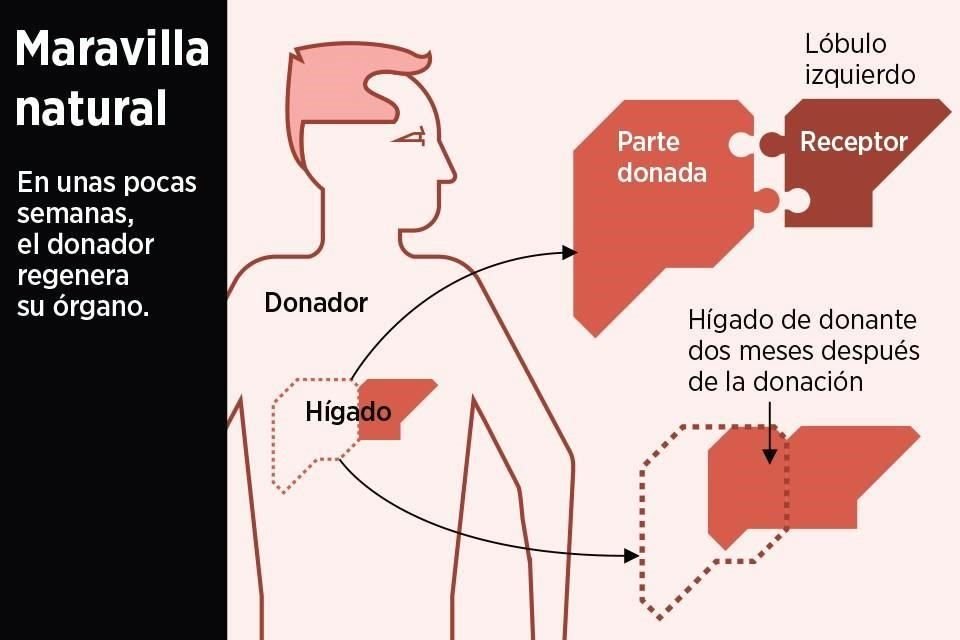 Entre los beneficios de esta forma de trasplante está el que las personas que reciben parte del hígado de un donante vivo suelen tener mejores índices de supervivencia a corto plazo.