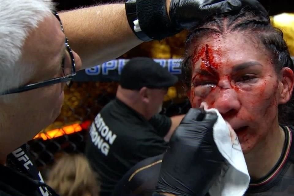 Así quedó el rostro de la peleadora mexicana Irene Aldana tras su combate contra Norma Dumont.