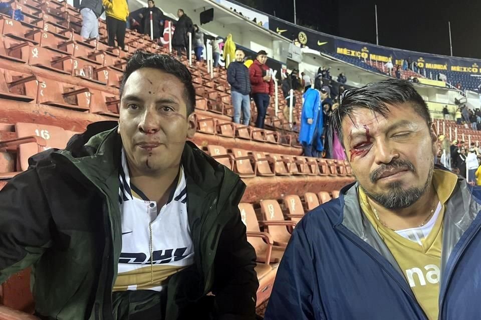 Así quedaron dos aficionados de Pumas que fueron agredidos por los americanistas tras el Clásico Capitalino.