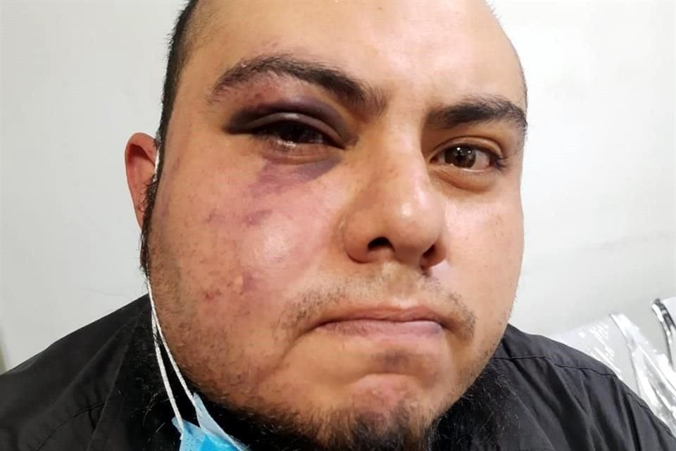 Agentes de la SSC son acusados de detener de forma arbitraria a dos hermanos y agredir sexualmente a una joven, en Miguel Ángel de Quevedo, Coyoacán.