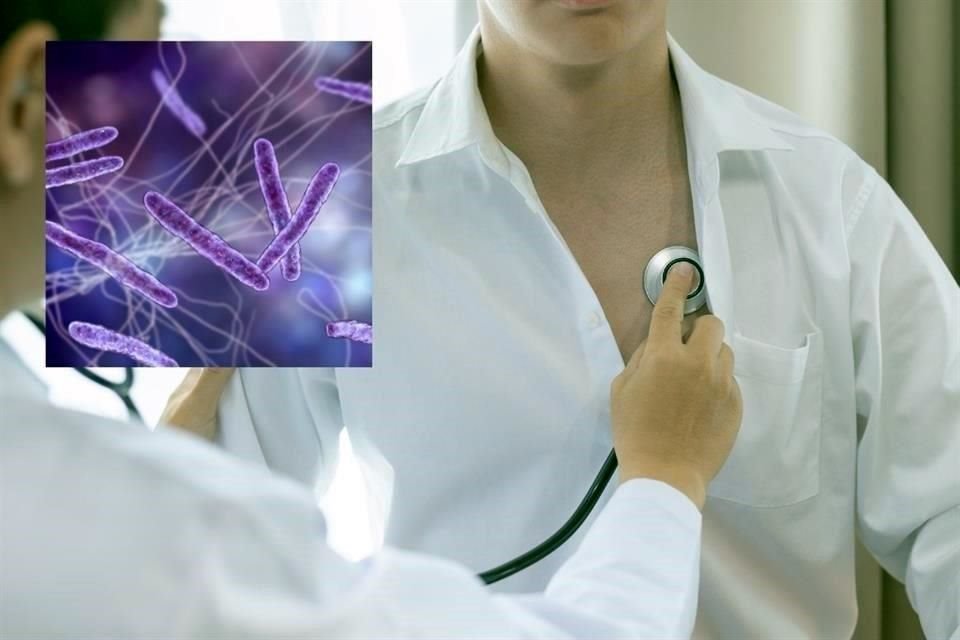 La tuberculosis respiratoria afecta principalmente a hombres, quienes representan el 65 por ciento de los casos.