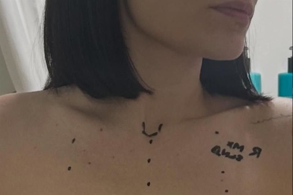 Otro video la muestra en recuperación en su cama de hospital, justo cuando despertaba tras la operación, señalando la zona del pecho, llena de cicatrices y vendada.