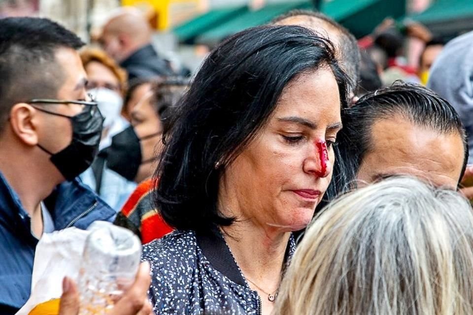 Lía Limón terminó con la nariz herida.