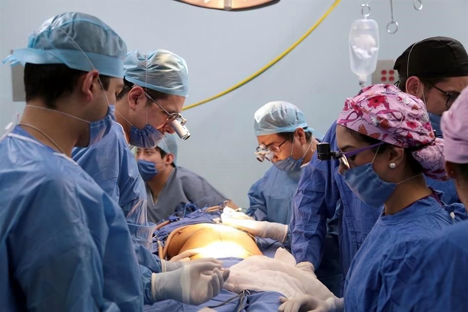 Cirujanos del IMSS realizan la reconstrucción del seno con técnicas innovadoras de microcirugía, en las que utilizan grasa y piel del abdomen de la misma paciente, junto con una arteria y una vena.