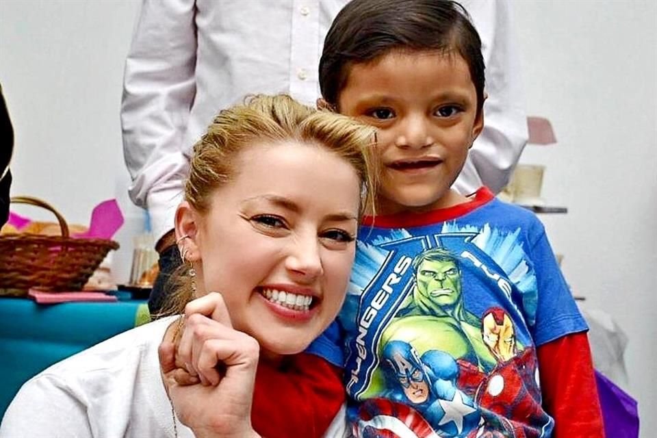 La actriz Amber Heard vino al País para apoyar cirugías gratuitas de niños con labio y paladar hendido.