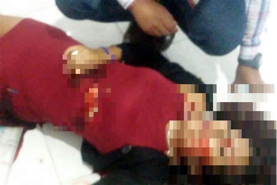 La mujer fue trasladada a un hospital.