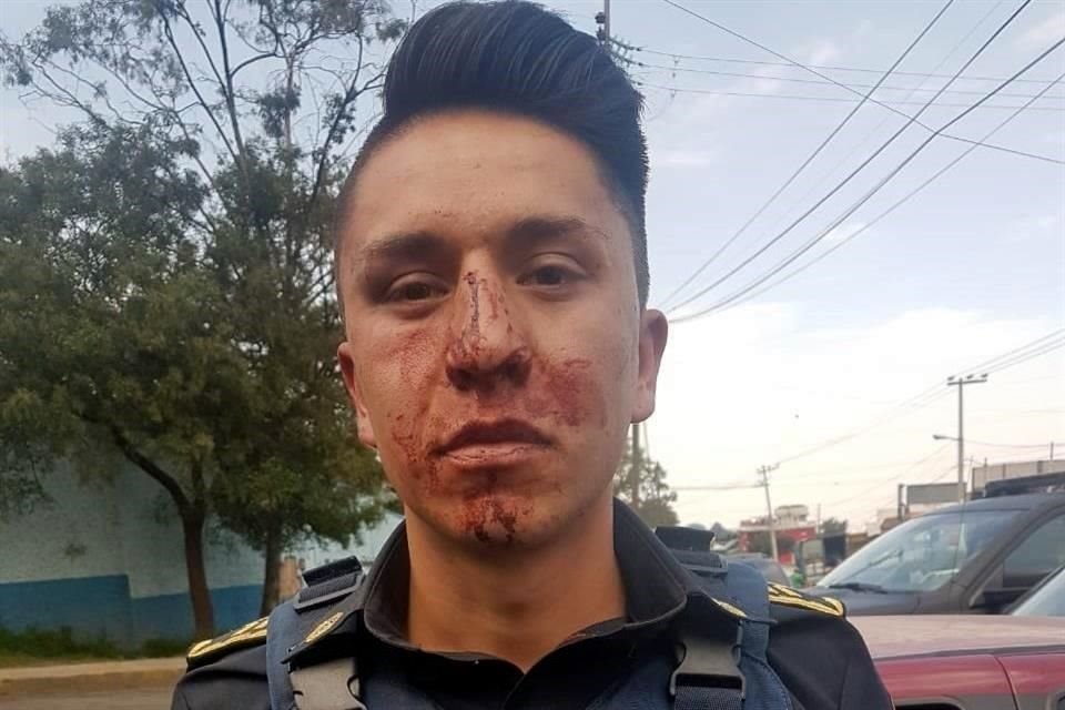 Uno de los policías fue agredido por el asaltante.