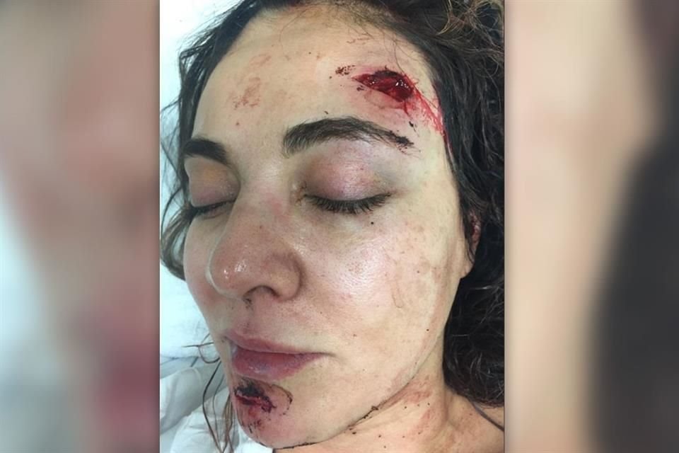 Javier Pérez Sagaón compartió imágenes de las lesiones provocadas por el ex esposo de Abril.