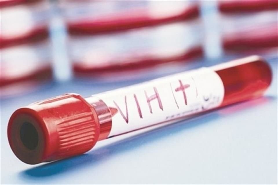 A nivel nacional, la tasa de mortalidad por VIH registrada por la Secretaría de Salud en 2018 fue de 4 por cada 100 mil habitantes. .