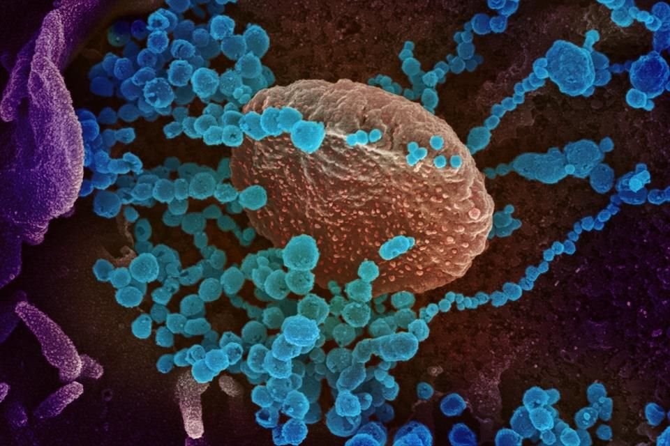 Fotografía del Instituto Nacional de Alergias y Enfermedades Infecciosas (NIAID) de una imagen de microscopio electrónico que muestra (objetos en azul) al SARS-CoV-2.