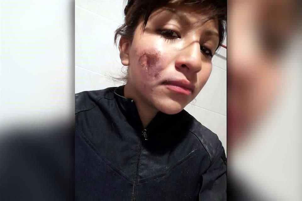 Una mujer policía, que resguardaba la marcha del 8M, denunció que una encapuchada le roció una sustancia que le quemó parte del rostro.