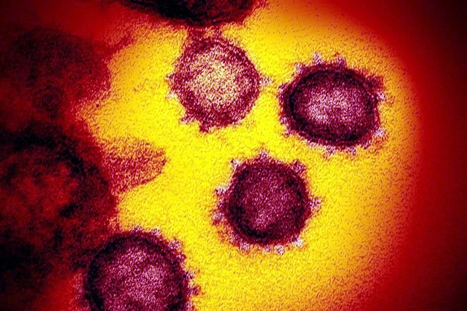 Científicos australianos descubrieron cómo sistema inmune ataca al Covid-19, información que podría ayudar a hallar una vacuna contra este.