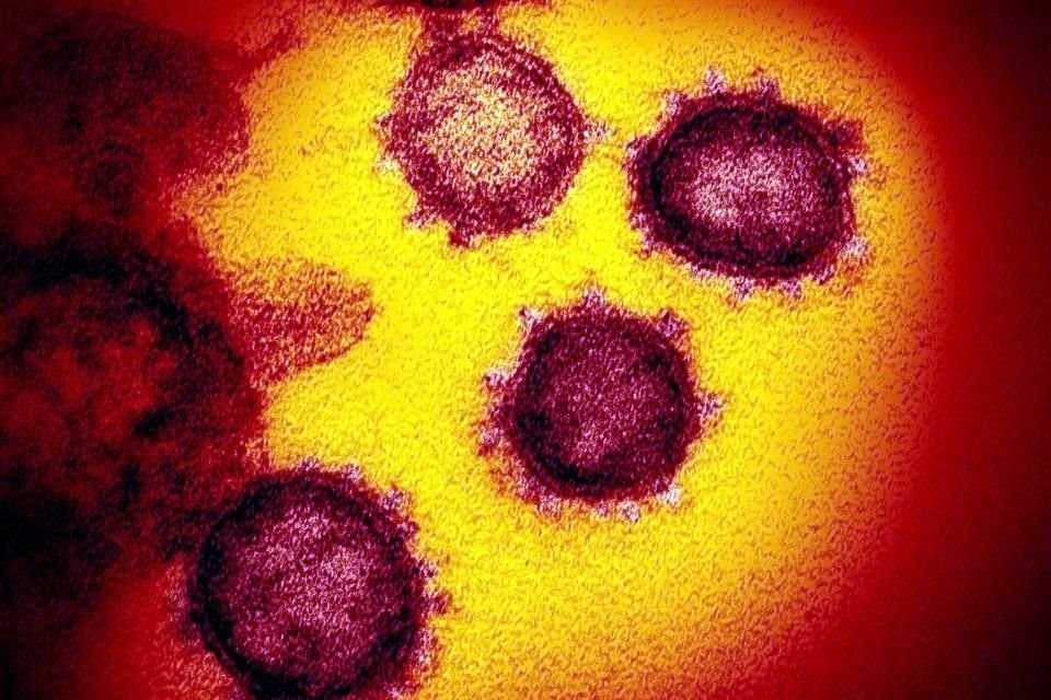 Imagen microscópica del nuevo coronavirus que causa el Covid-19.