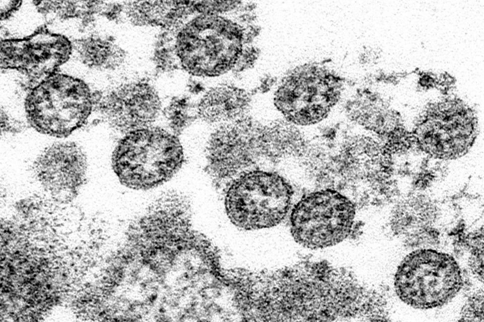 Partículas del nuevo coronavirus en una imagen microscópica de los CDC de EU.