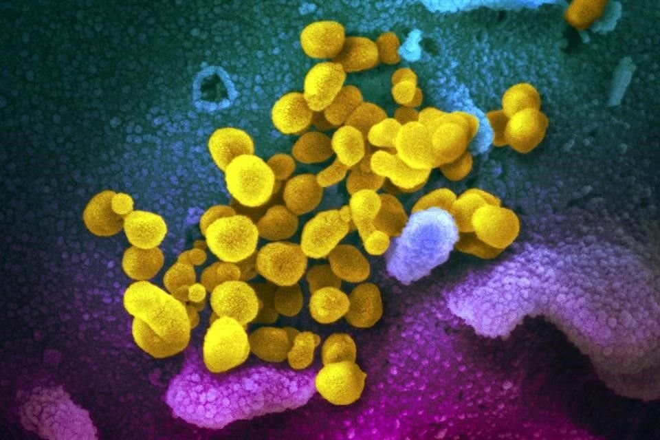 Una imagen microscópica obtenida en febrero por investigadores en EU del SARS-Cov-2, virus que provoca el Covid-19.