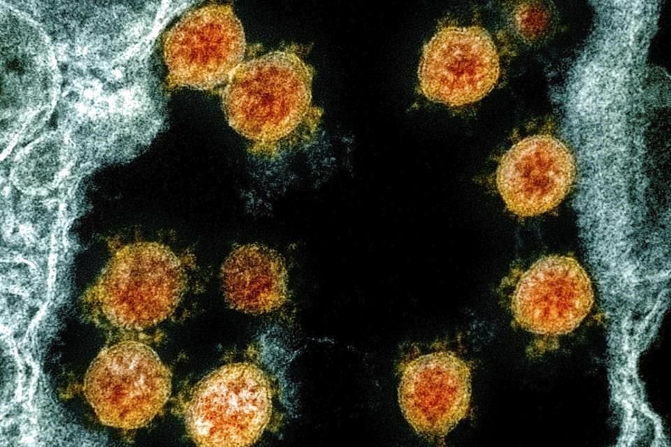 Partículas del nuevo coronavirus, SARS-CoV-2, en la imagen de un microscopio de electrones.