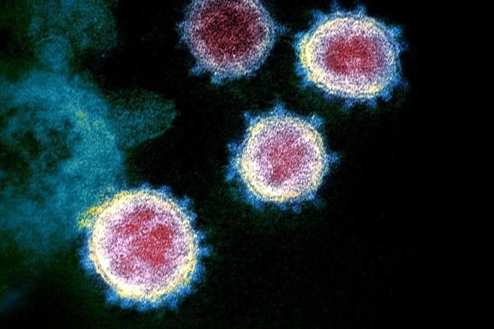 Una imagen de microscopio del virus SARS-Cov-2, causante del Covid-19.